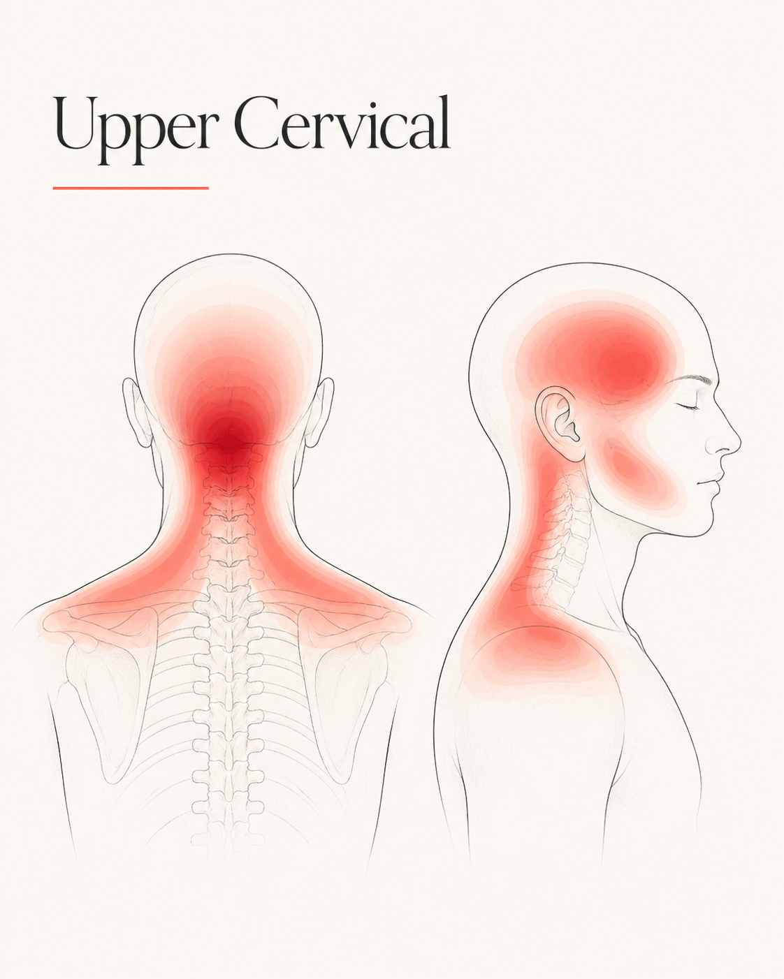 Upper Cervical pain pattern