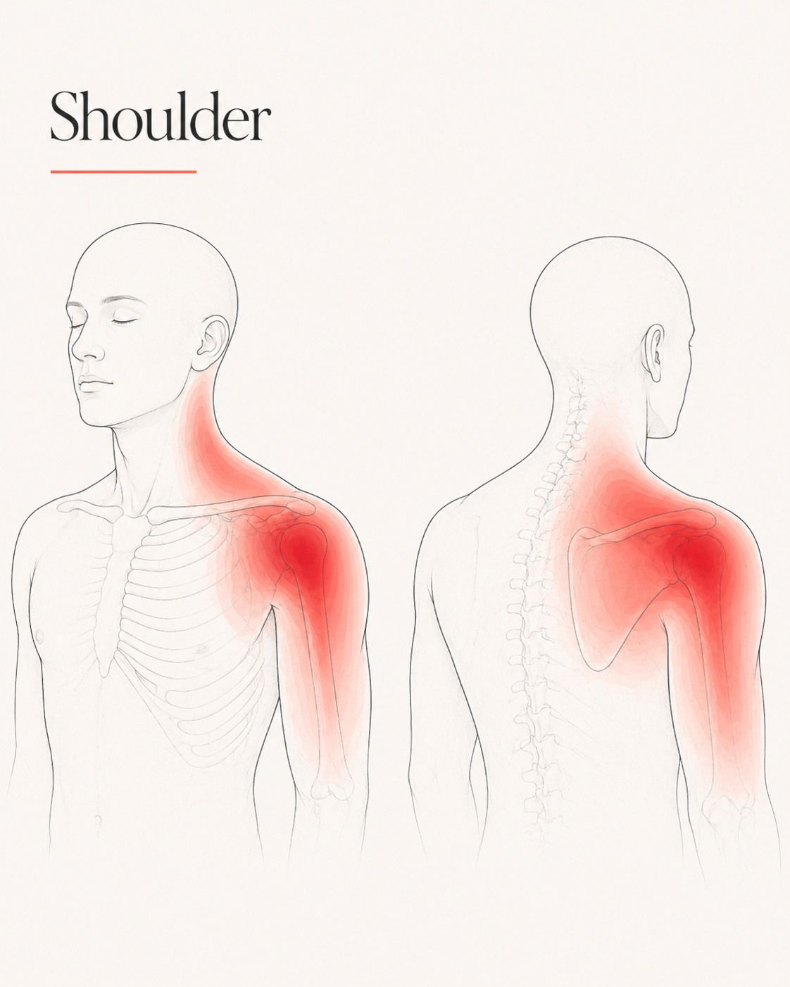Shoulder pain pattern