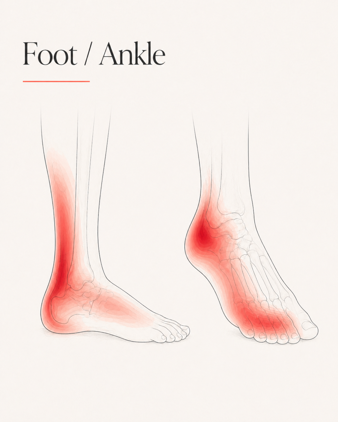 Foot and Ankle pain pattern